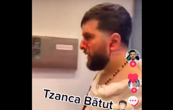 Trzanca batut