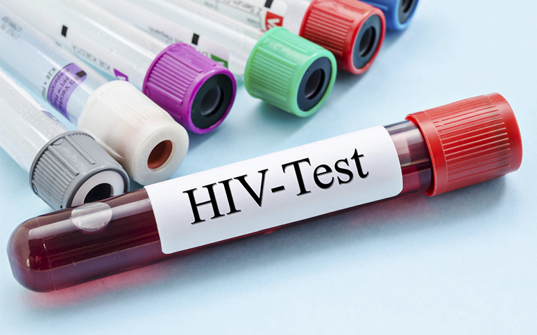 variantă nouă HIV olanda