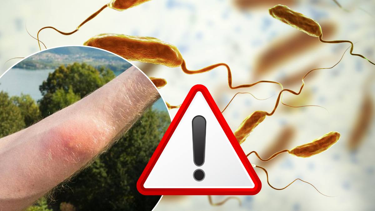 Bacterii periculoase în apă