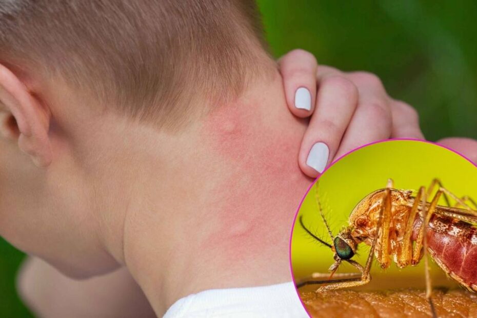 O femeie moare infectarea virusul West Nile