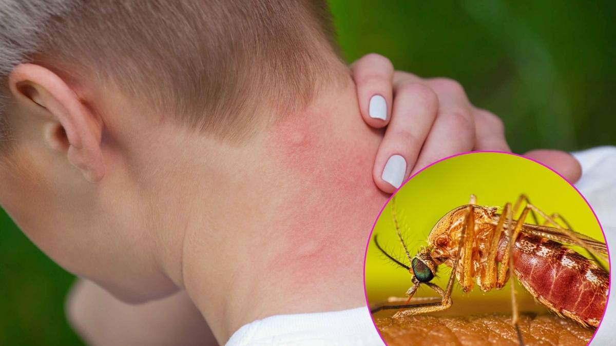 O femeie moare infectarea virusul West Nile